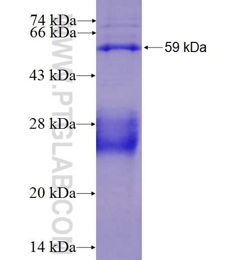 BRSK1 fusion protein Ag3357 SDS-PAGE