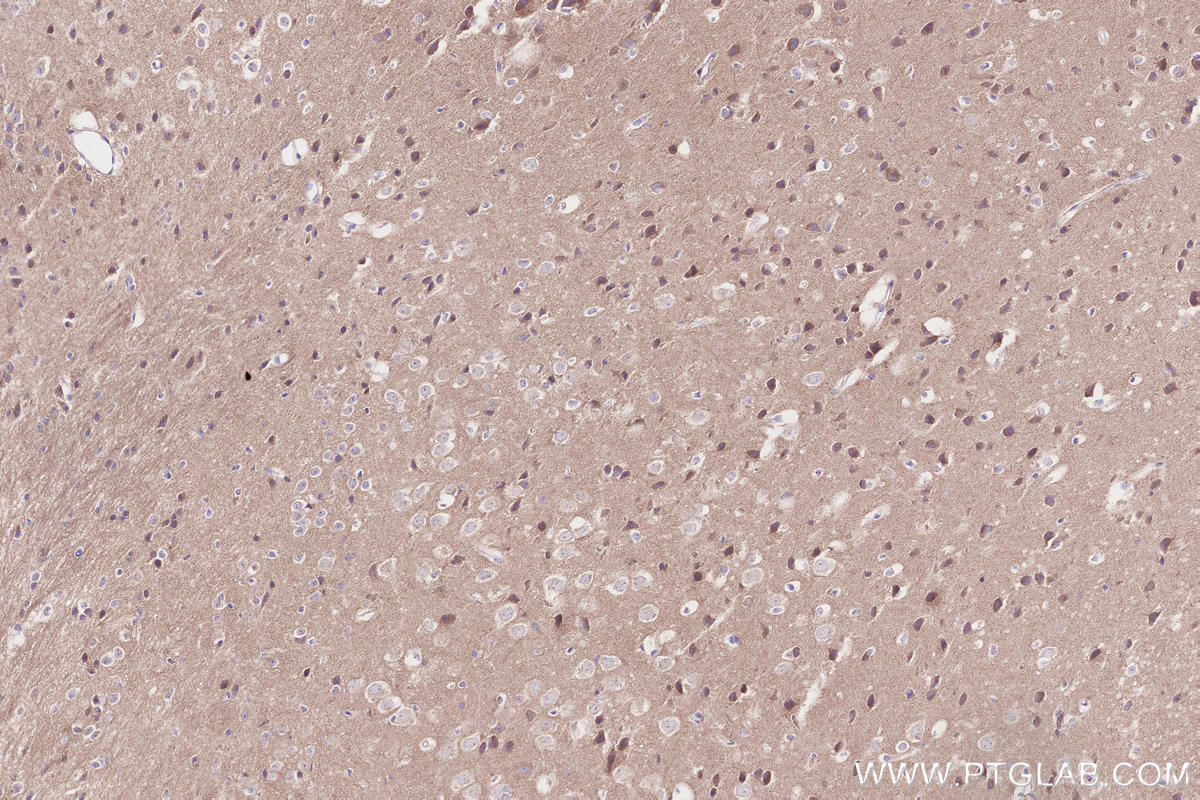 Immunohistochemistry (IHC) staining of mouse brain tissue using BRSK2 Polyclonal antibody (11589-1-AP)