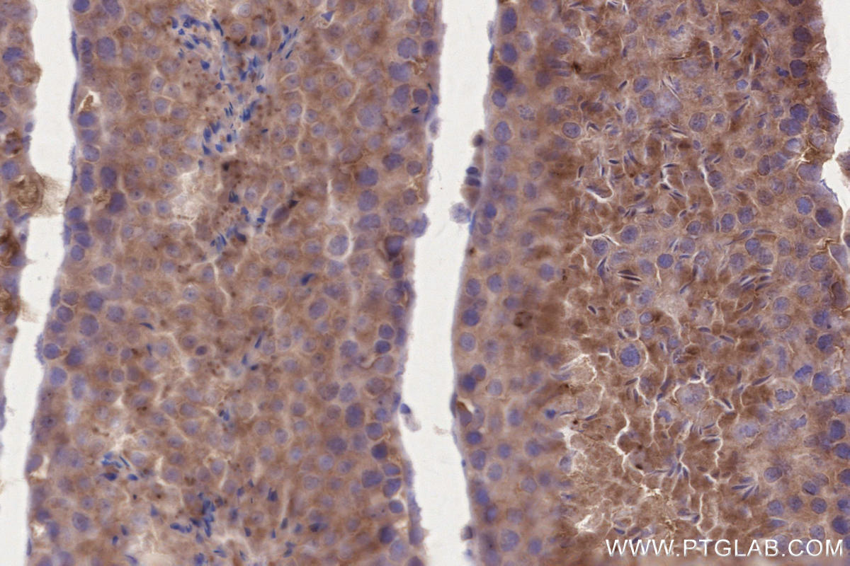 Immunohistochemistry (IHC) staining of mouse testis tissue using BRSK2 Polyclonal antibody (11589-1-AP)