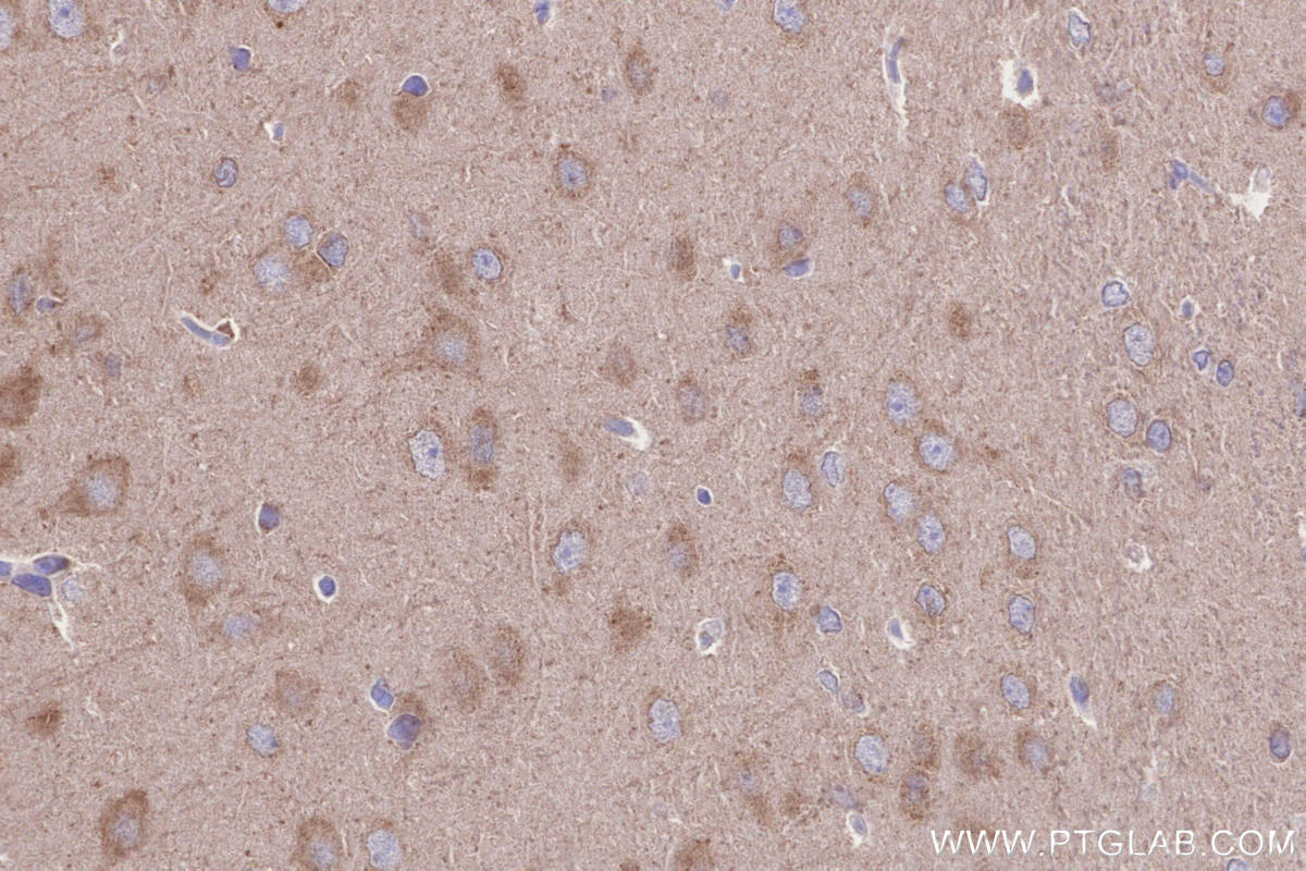 Immunohistochemistry (IHC) staining of rat brain tissue using BRSK2 Polyclonal antibody (11589-1-AP)