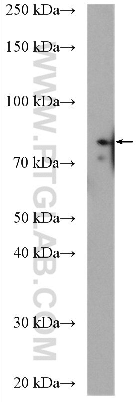 Western Blot (WB) analysis of mouse brain tissue using BRSK2 Polyclonal antibody (11589-1-AP)