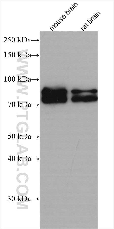 Western Blot (WB) analysis of various lysates using BRSK2 Polyclonal antibody (11589-1-AP)