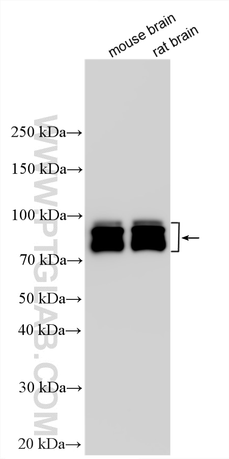 WB analysis using 11589-1-AP Western Blot (WB) analysis of various lysates using BRSK2 Polyclonal antibody (11589-1-AP)