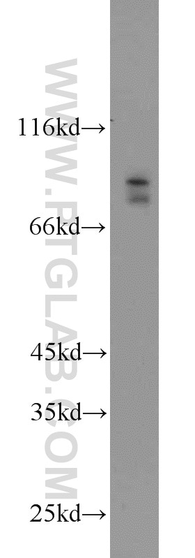 Western Blot (WB) analysis of mouse brain tissue using BRSK2 Polyclonal antibody (11589-1-AP)