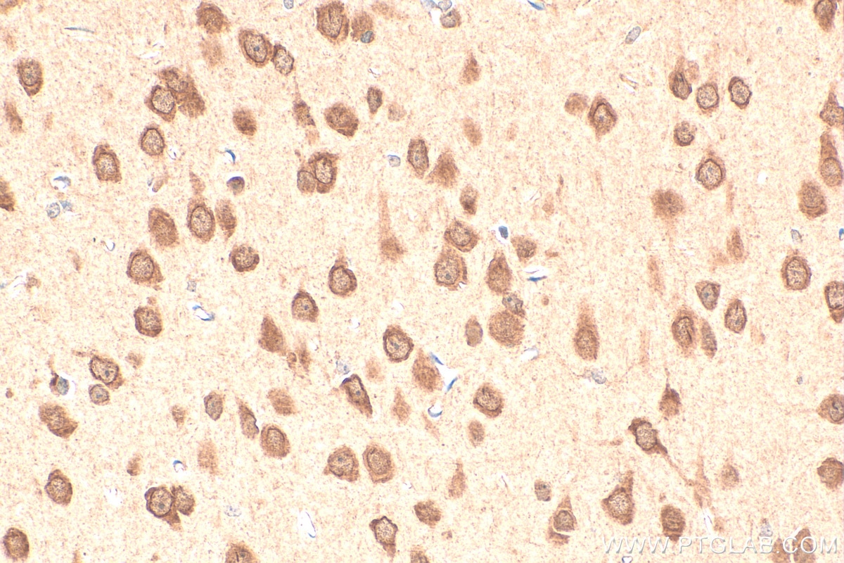 IHC staining of rat brain using 13557-1-AP