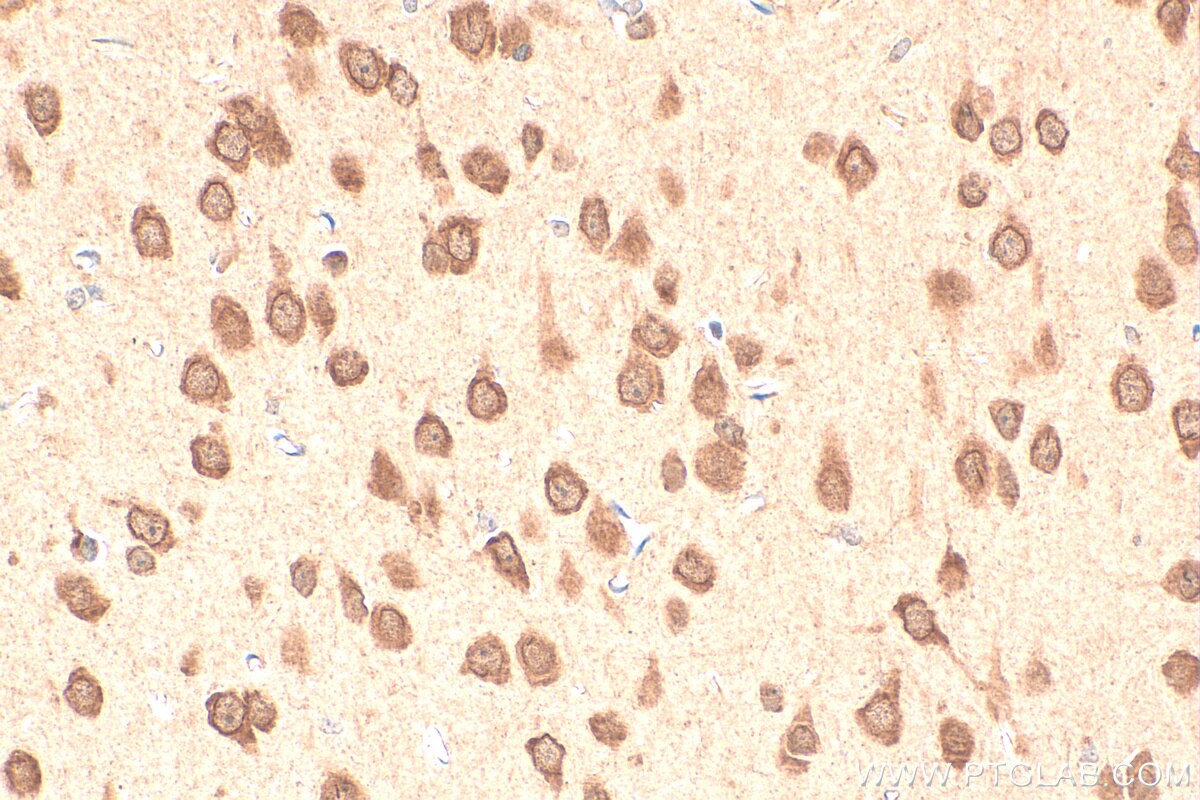 Immunohistochemistry (IHC) staining of rat brain tissue using BRUNOL5 Polyclonal antibody (13557-1-AP)