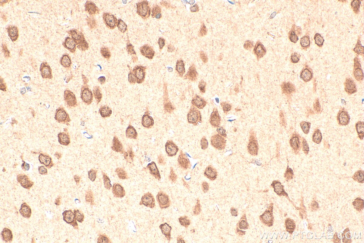 IHC staining of rat brain using 13557-1-AP