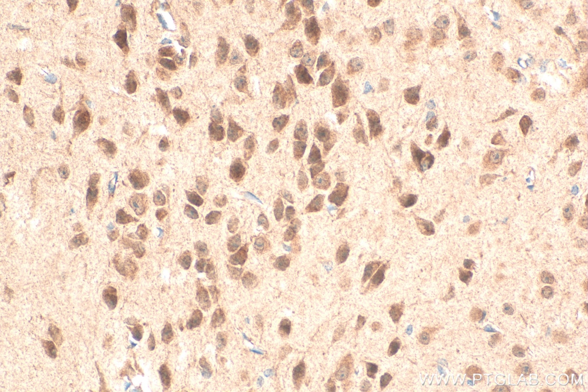 Immunohistochemistry (IHC) staining of mouse brain tissue using BRUNOL5 Polyclonal antibody (13557-1-AP)