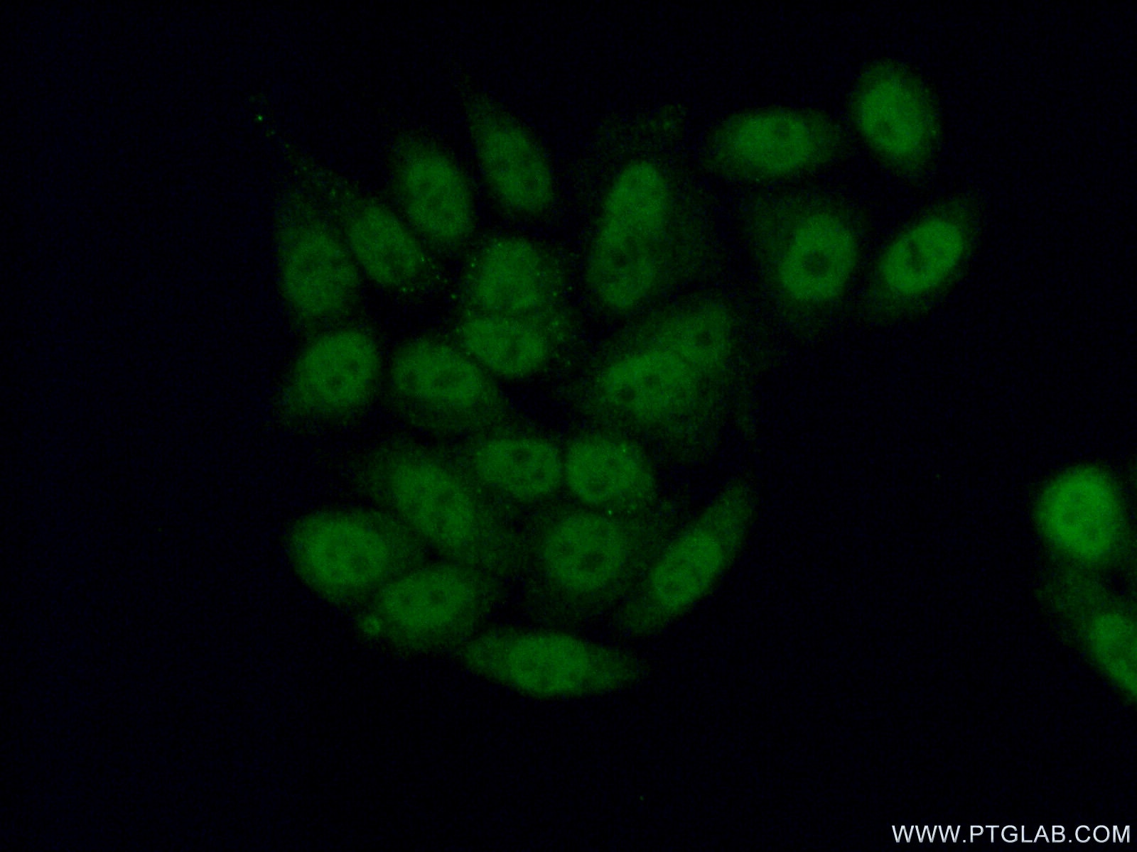 Immunofluorescence (IF) / fluorescent staining of HeLa cells using BRUNOL6 Polyclonal antibody (19078-1-AP)