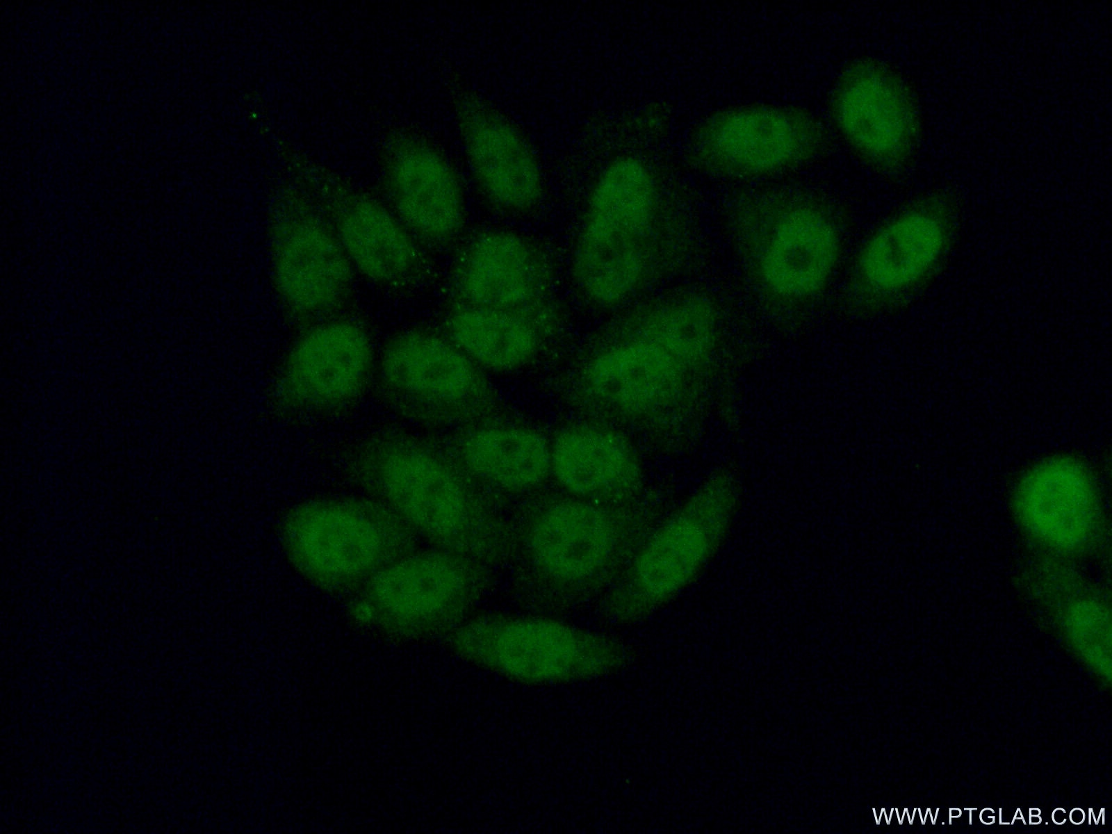 IF Staining of HeLa using 19078-1-AP