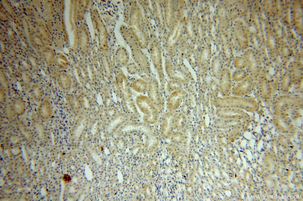 Immunohistochemistry (IHC) staining of human kidney tissue using BRUNOL6 Polyclonal antibody (19078-1-AP)