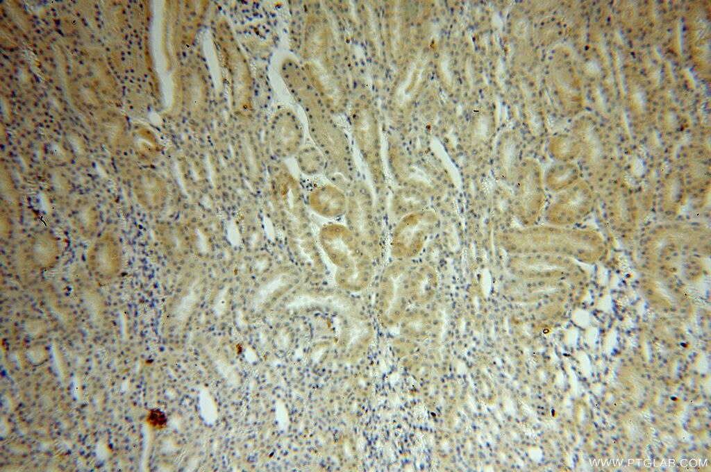 IHC staining of human kidney using 19078-1-AP