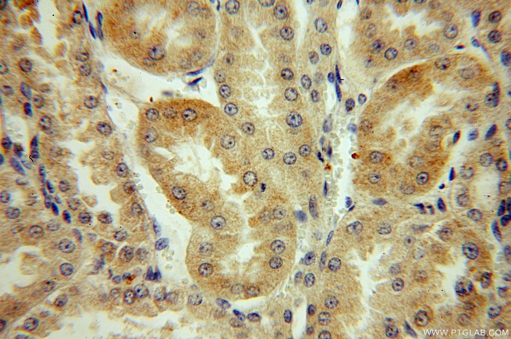 Immunohistochemistry (IHC) staining of human kidney tissue using BRUNOL6 Polyclonal antibody (19078-1-AP)