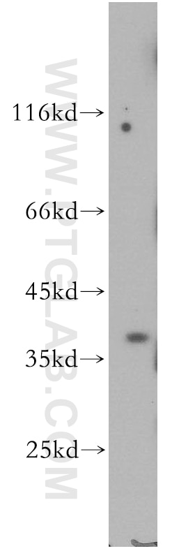 Western Blot (WB) analysis of HeLa cells using BRUNOL6 Polyclonal antibody (19078-1-AP)
