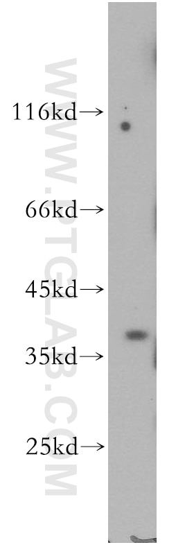 WB analysis of HeLa using 19078-1-AP