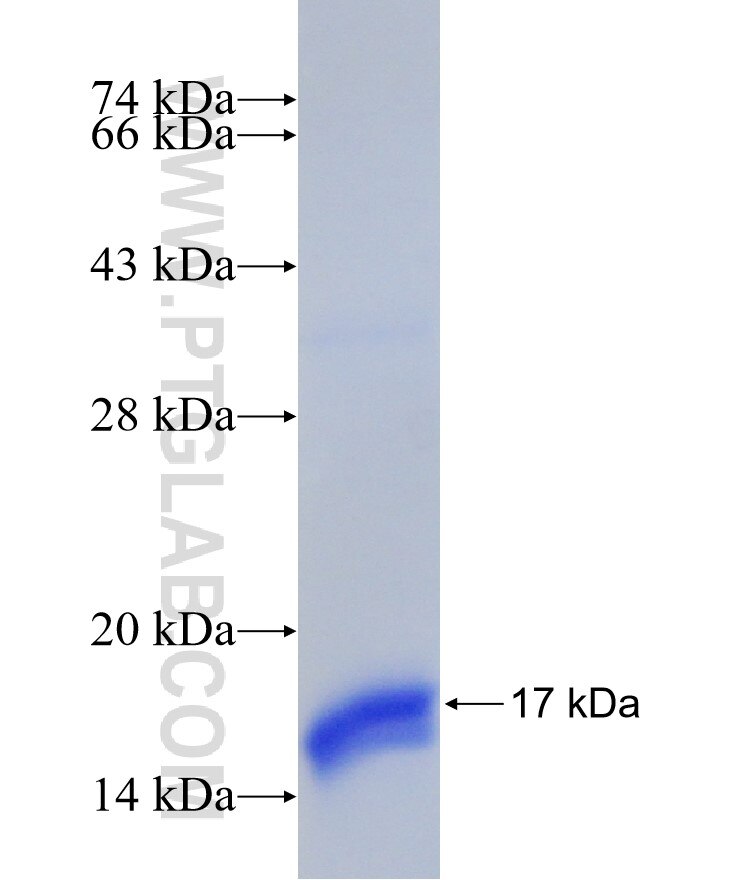 BRWD1 fusion protein Ag30940 SDS-PAGE