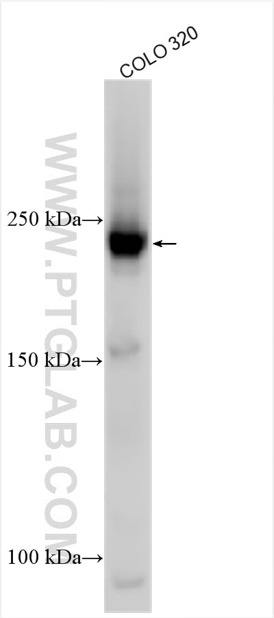 Western Blot (WB) analysis of various lysates using BRWD3 Polyclonal antibody (31795-1-AP)