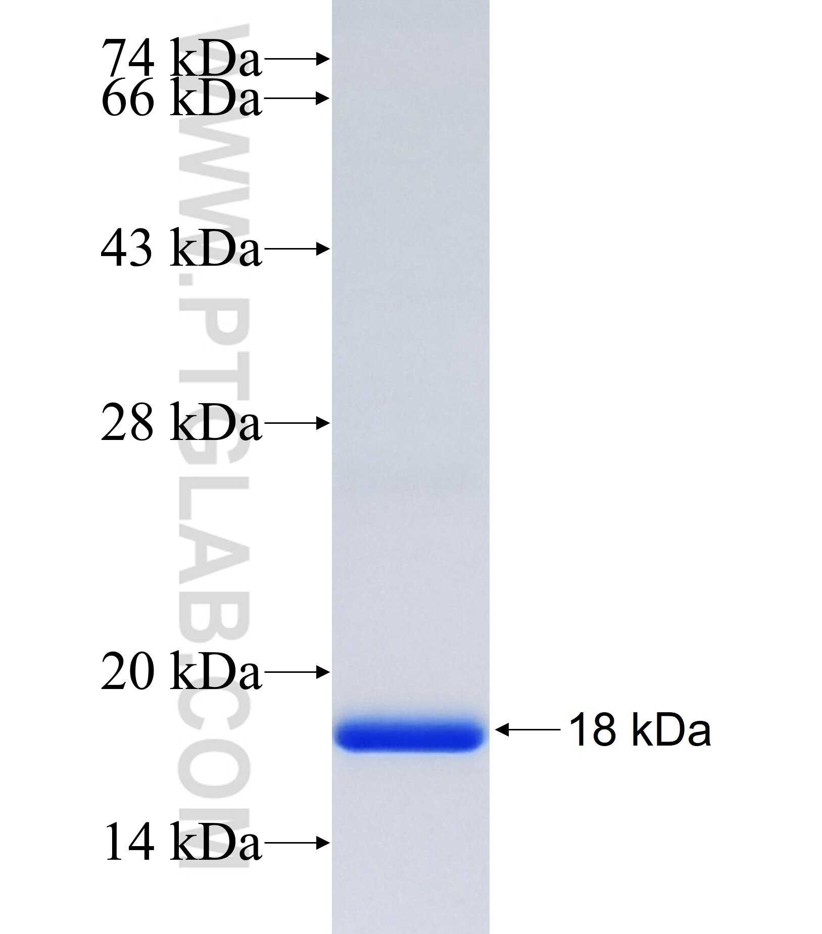 BRWD3 fusion protein Ag36961 SDS-PAGE BRWD3 fusion protein Ag36961 SDS-PAGE