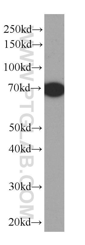 Western Blot (WB) analysis of bovine serum using BSA Monoclonal antibody (66201-1-Ig)