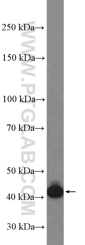 BSAP,PAX5 Polyclonal antibody