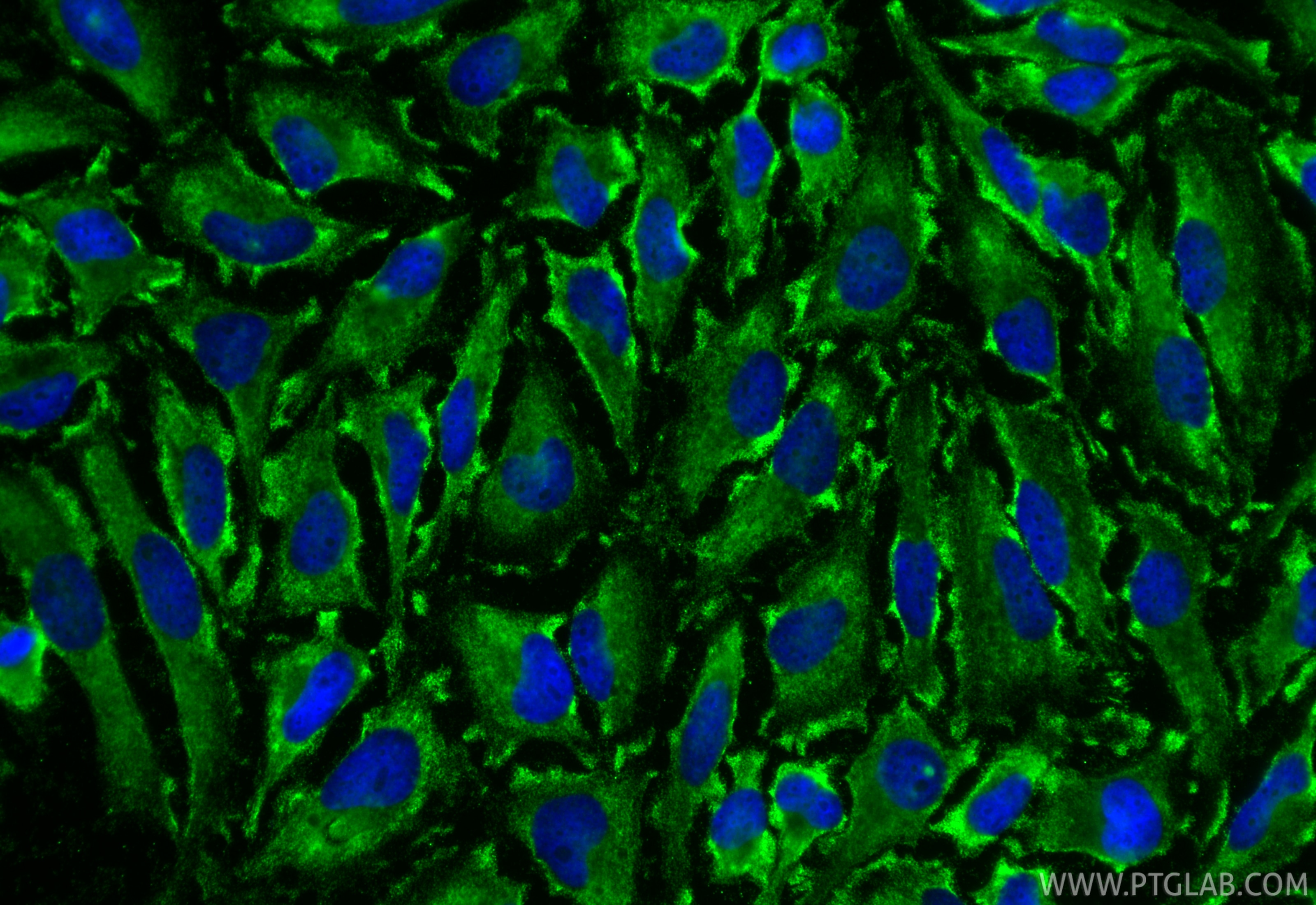 IF Staining of HeLa using 67512-1-Ig Immunofluorescence (IF) / fluorescent staining of HeLa cells using BSEP Monoclonal antibody (67512-1-Ig)