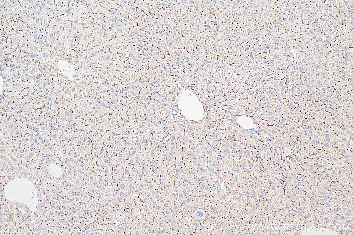 Immunohistochemistry (IHC) staining of mouse liver tissue using BSEP Monoclonal antibody (67512-1-Ig)