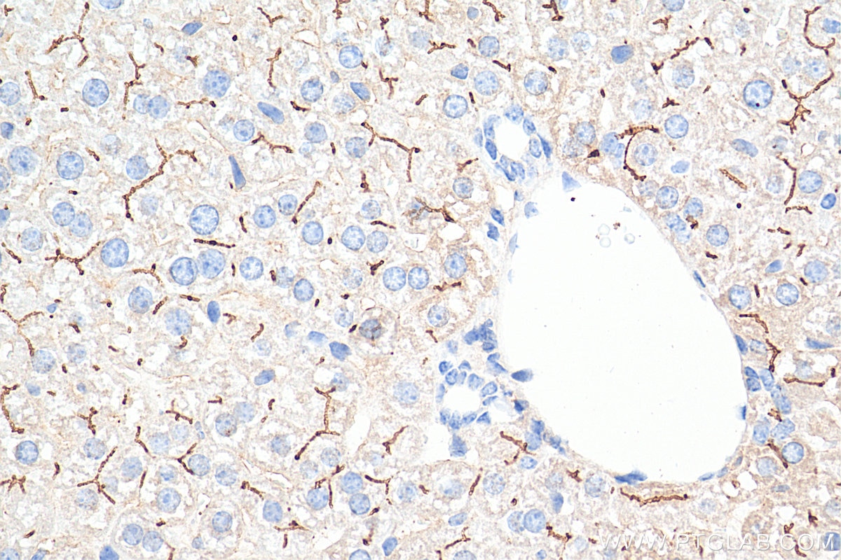 Immunohistochemistry (IHC) staining of mouse liver tissue using BSEP Monoclonal antibody (67512-1-Ig)
