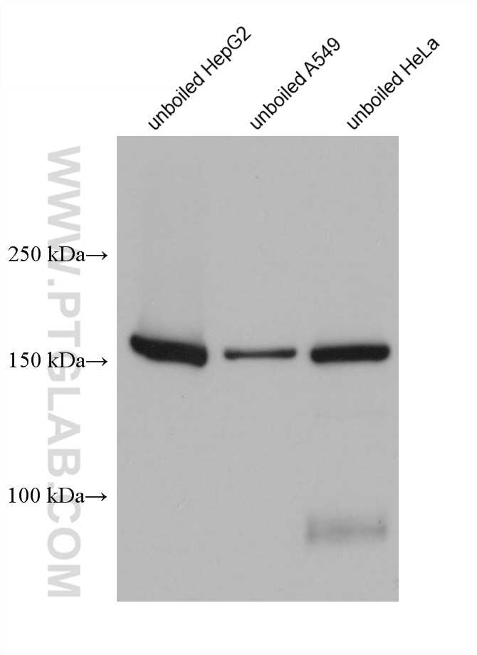 Western Blot (WB) analysis of various lysates using BSEP Monoclonal antibody (67512-1-Ig)
