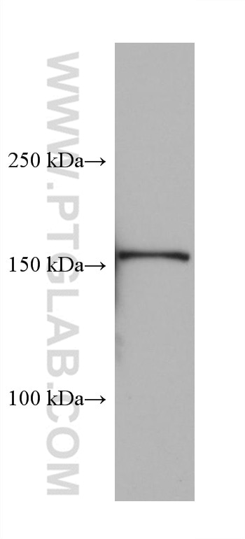 Western Blot (WB) analysis of pig lung tissue using BSEP Monoclonal antibody (67512-1-Ig)