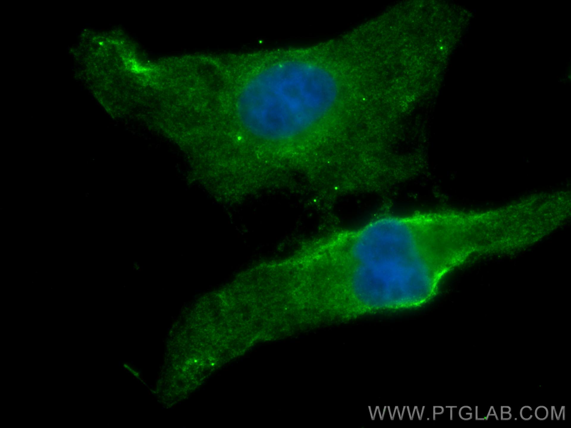 Immunofluorescence (IF) / fluorescent staining of HeLa cells using CoraLite® Plus 488-conjugated BSEP Monoclonal anti (CL488-67512)