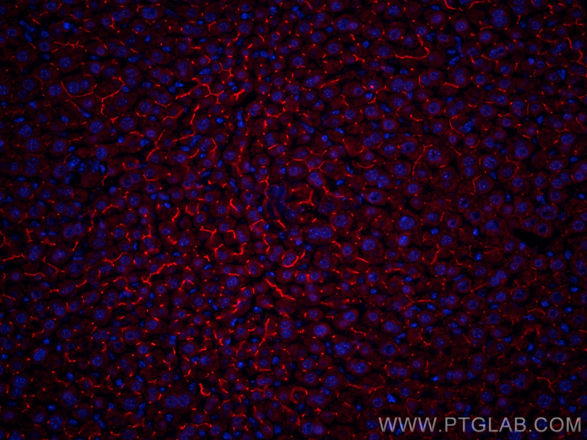 IF Staining of mouse liver using CL594-67512
