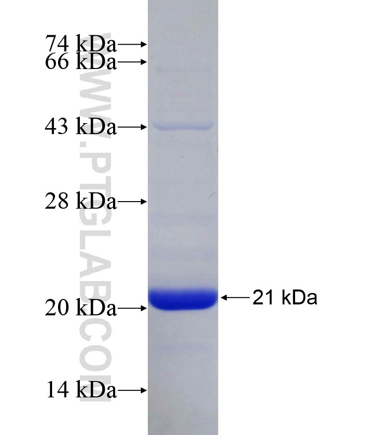 BSEP fusion protein Ag29135 SDS-PAGE