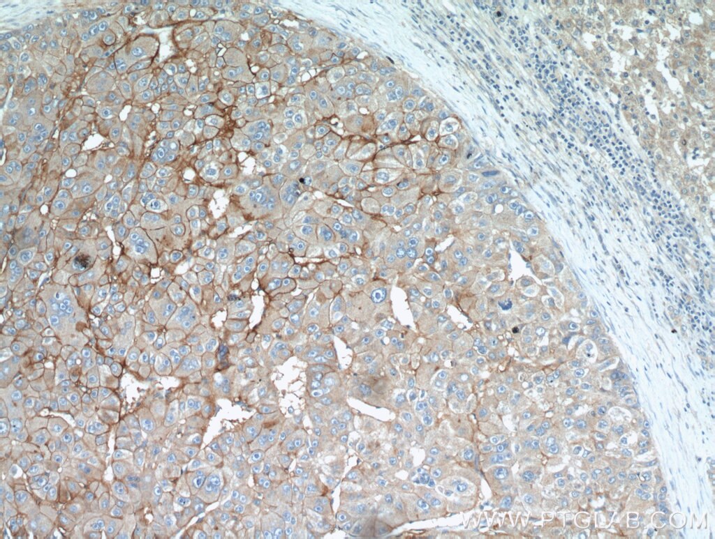 CD147 Polyclonal antibody