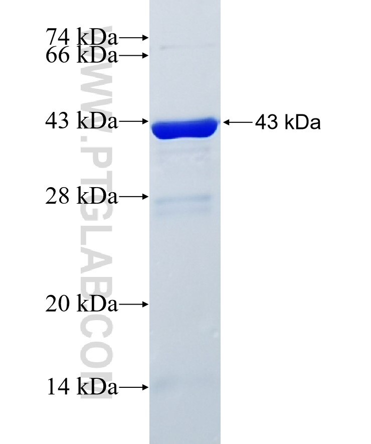 BSN fusion protein Ag26368 SDS-PAGE