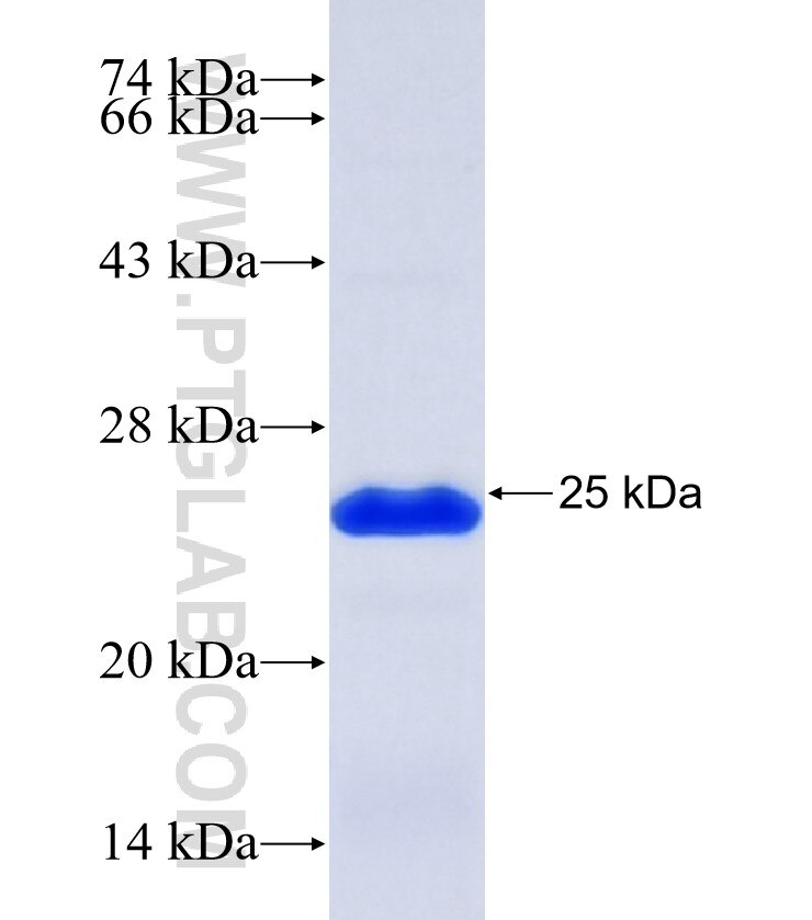 BSN fusion protein Ag26434 SDS-PAGE