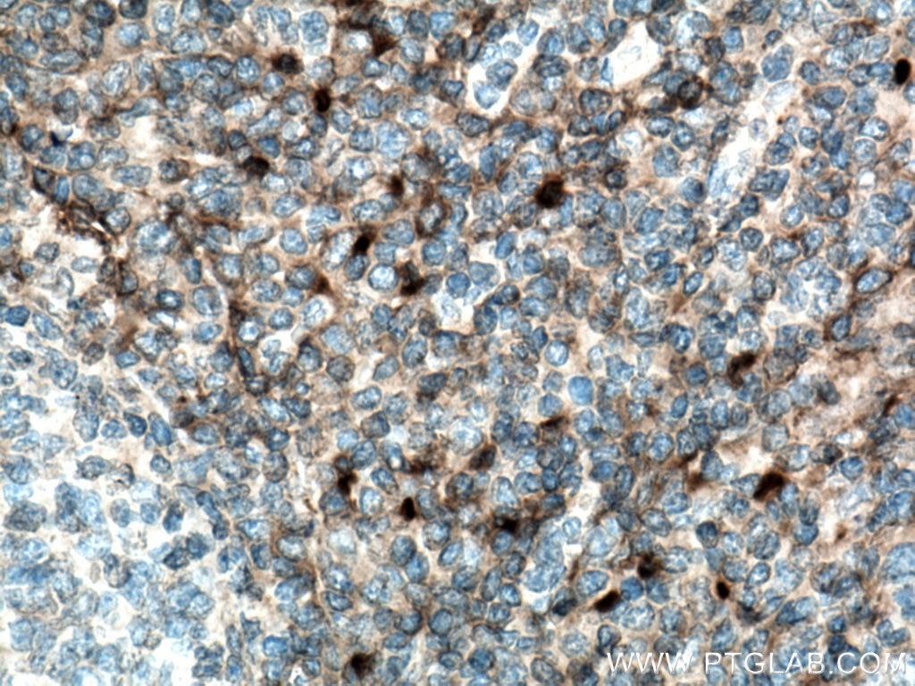 Immunohistochemistry (IHC) staining of human tonsillitis tissue using CD157 Polyclonal antibody (16337-1-AP)