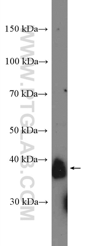 Western Blot (WB) analysis of A549 cells using CD157 Polyclonal antibody (16337-1-AP)