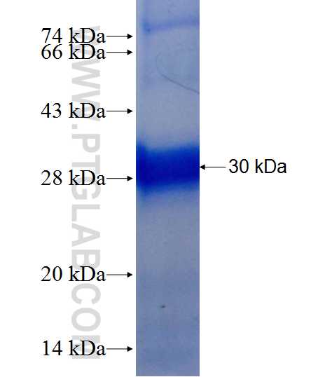 BST1 fusion protein Ag9478 SDS-PAGE