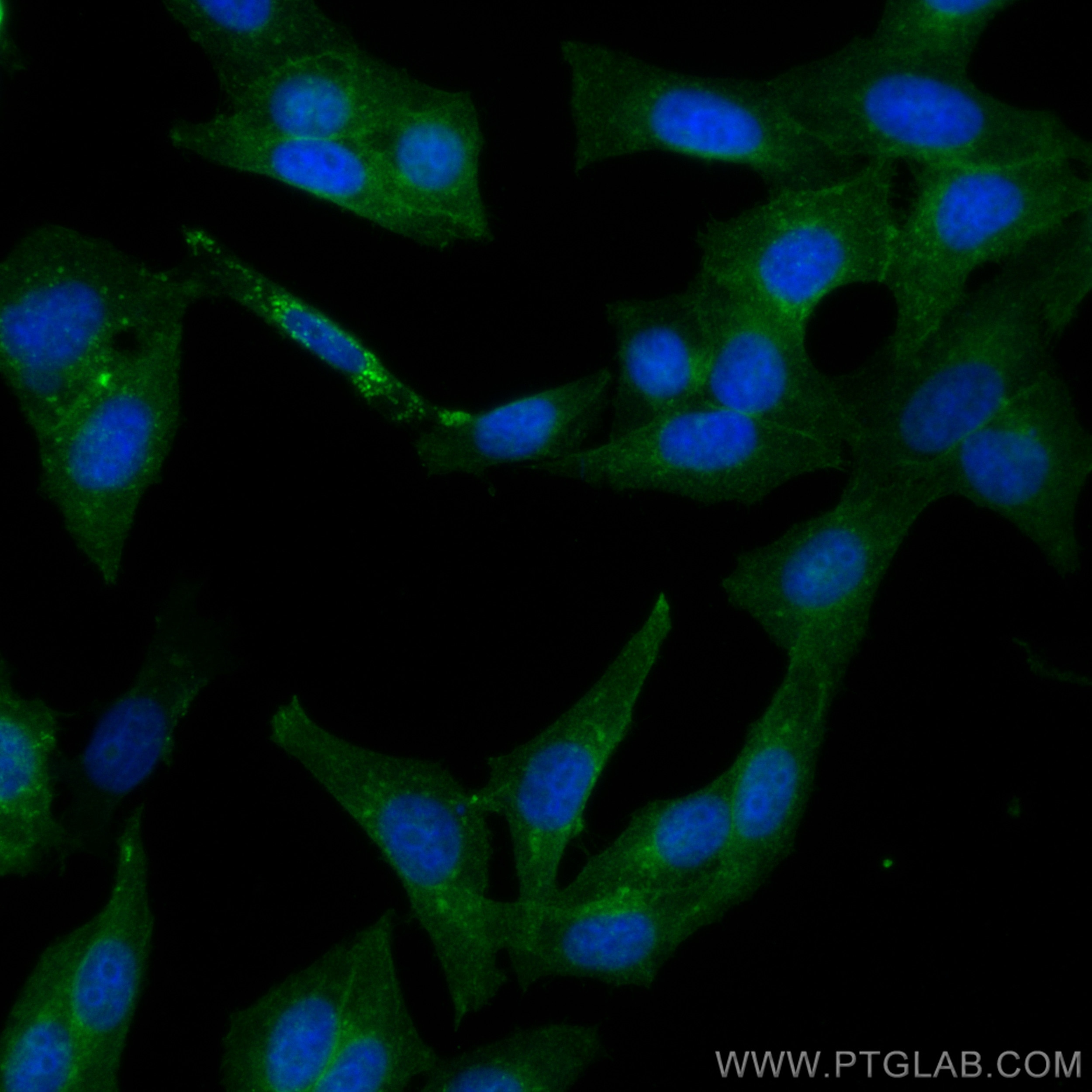 Immunofluorescence (IF) / fluorescent staining of HepG2 cells using BST2 Polyclonal antibody (13560-1-AP)
