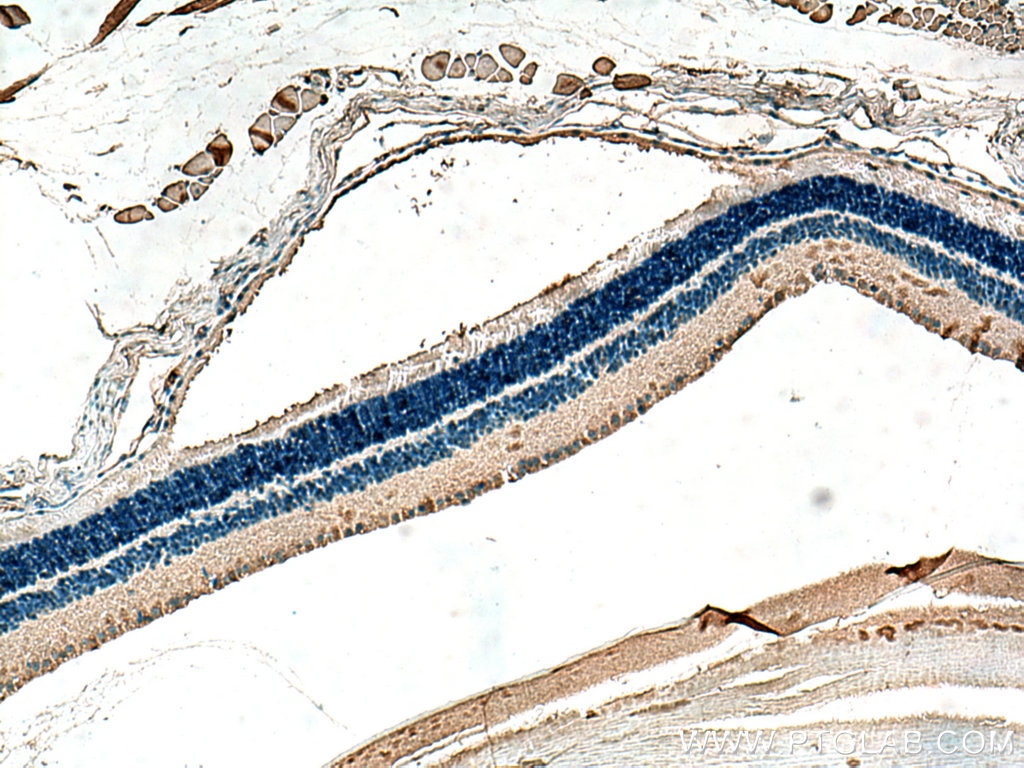 Immunohistochemistry (IHC) staining of mouse eye tissue using BST2 Polyclonal antibody (13560-1-AP)