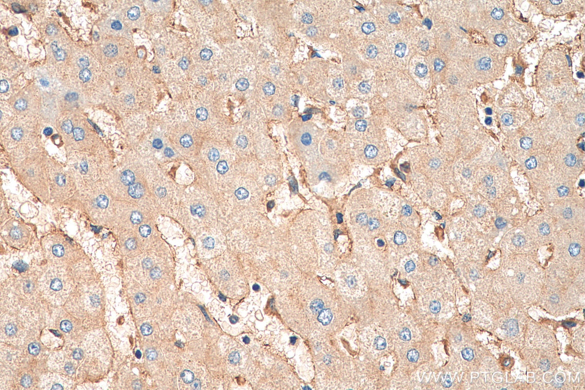 IHC staining of human liver using 13560-1-AP