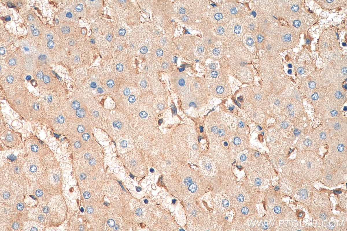 Immunohistochemistry (IHC) staining of human liver tissue using BST2 Polyclonal antibody (13560-1-AP)