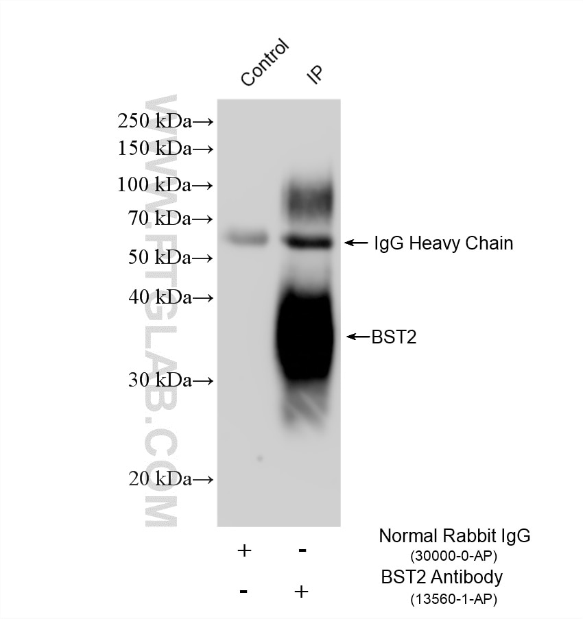 Immunoprecipitation (IP) experiment of HeLa cells using BST2 Polyclonal antibody (13560-1-AP)