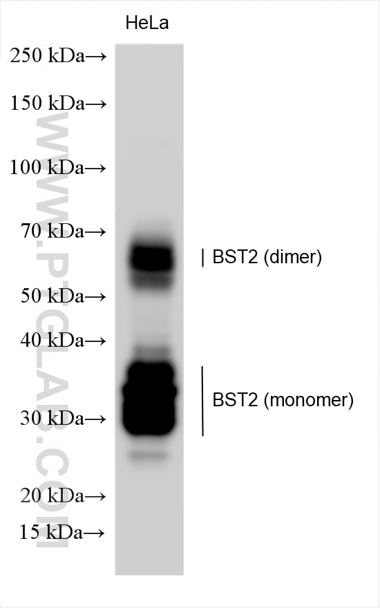 Western Blot (WB) analysis of HeLa cells using BST2 Polyclonal antibody (30118-1-AP)