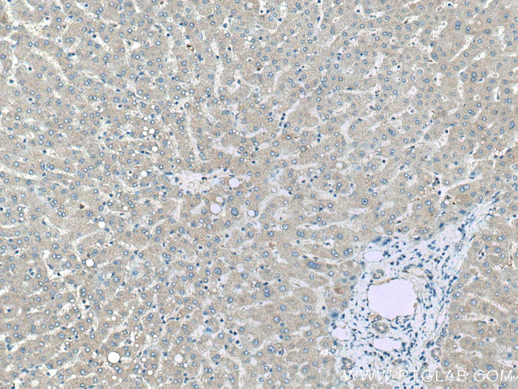 Immunohistochemistry (IHC) staining of human liver tissue using BST2 Monoclonal antibody (66919-1-Ig)