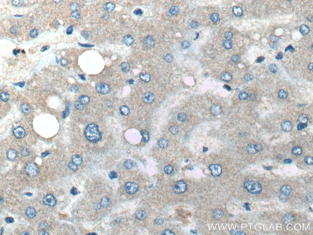Immunohistochemistry (IHC) staining of human liver tissue using BST2 Monoclonal antibody (66919-1-Ig)