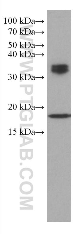 Western Blot (WB) analysis of HeLa cells using BST2 Monoclonal antibody (66919-1-Ig)