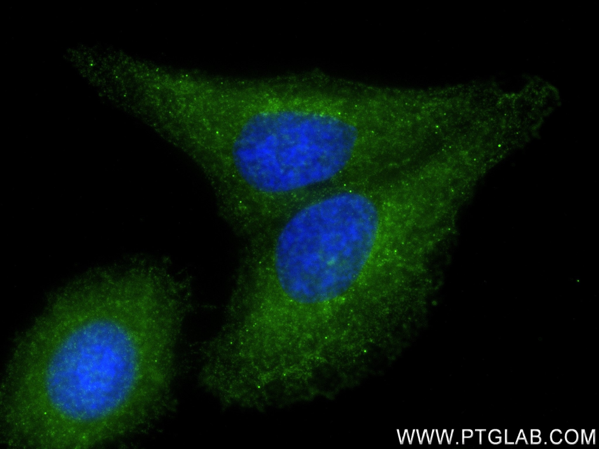 IF Staining of HepG2 using 82733-7-RR