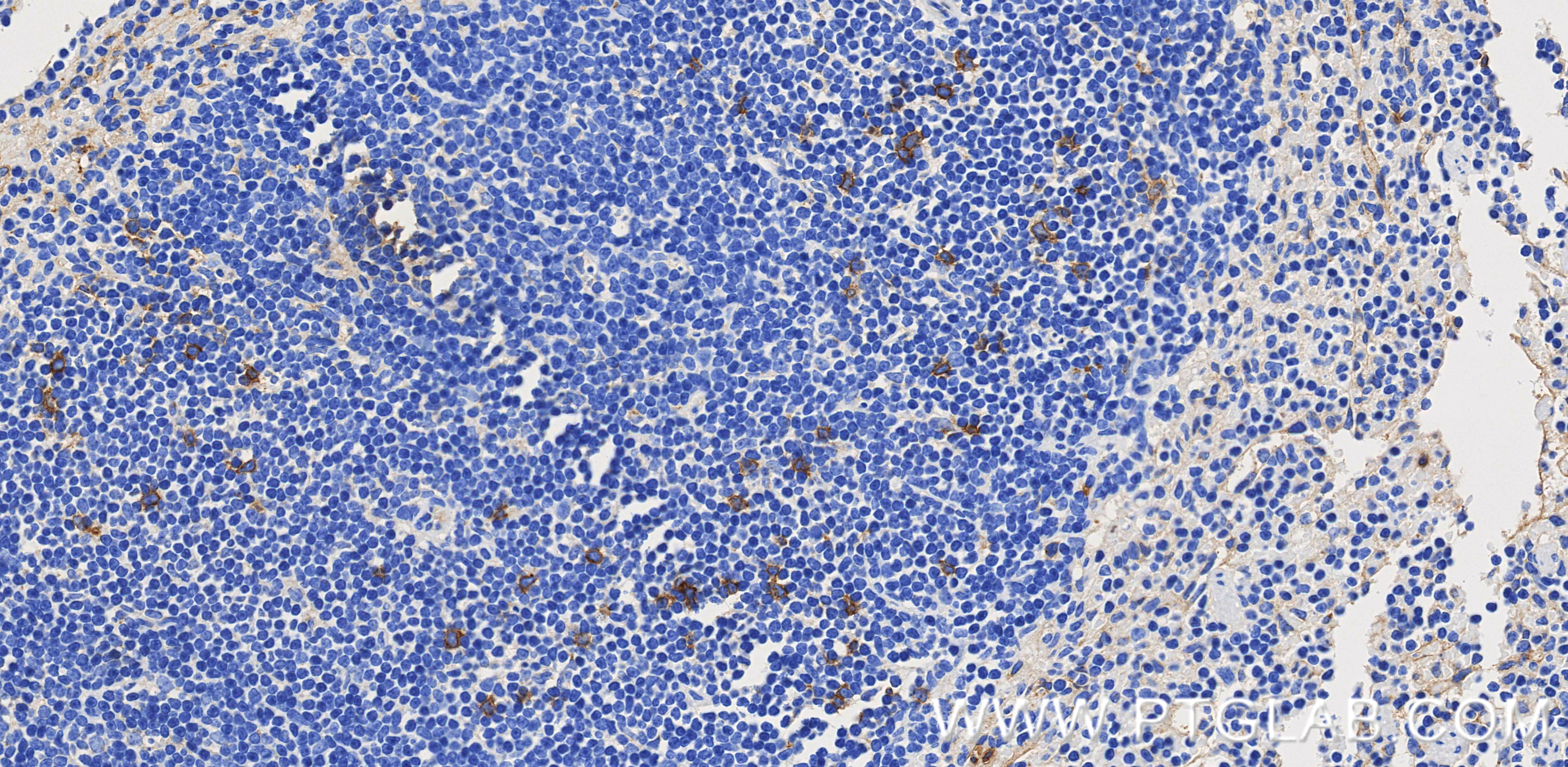 Immunohistochemistry (IHC) staining of mouse spleen tissue using BST2 Recombinant monoclonal antibody (85614-4-RR)