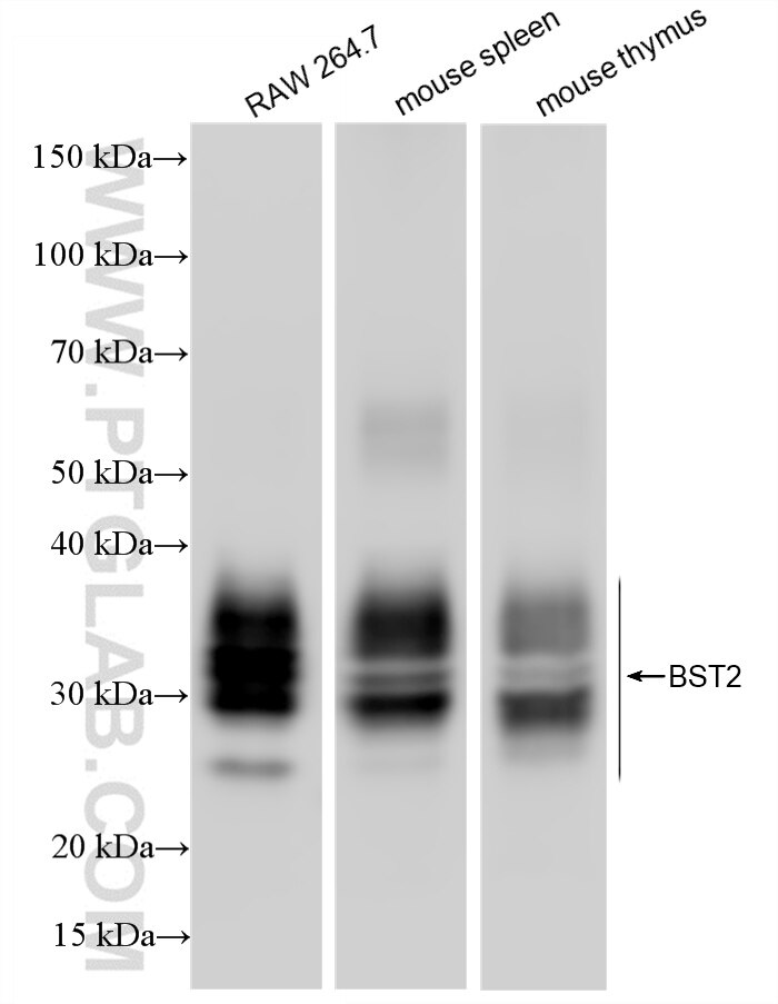 Western Blot (WB) analysis of various lysates using BST2 Recombinant antibody (85614-4-RR)